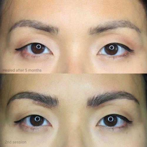 IMG 20170813 170911 582